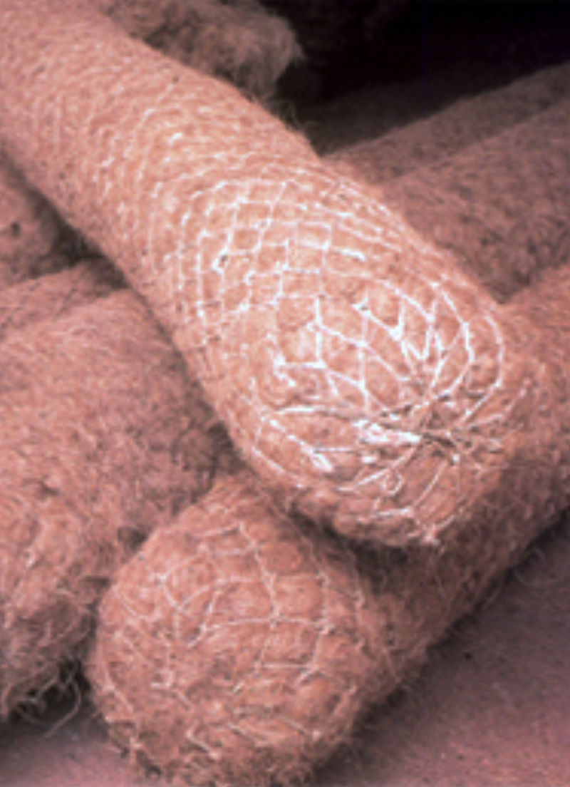 Kokosovi valji - erozijska zaščita strmih brežin